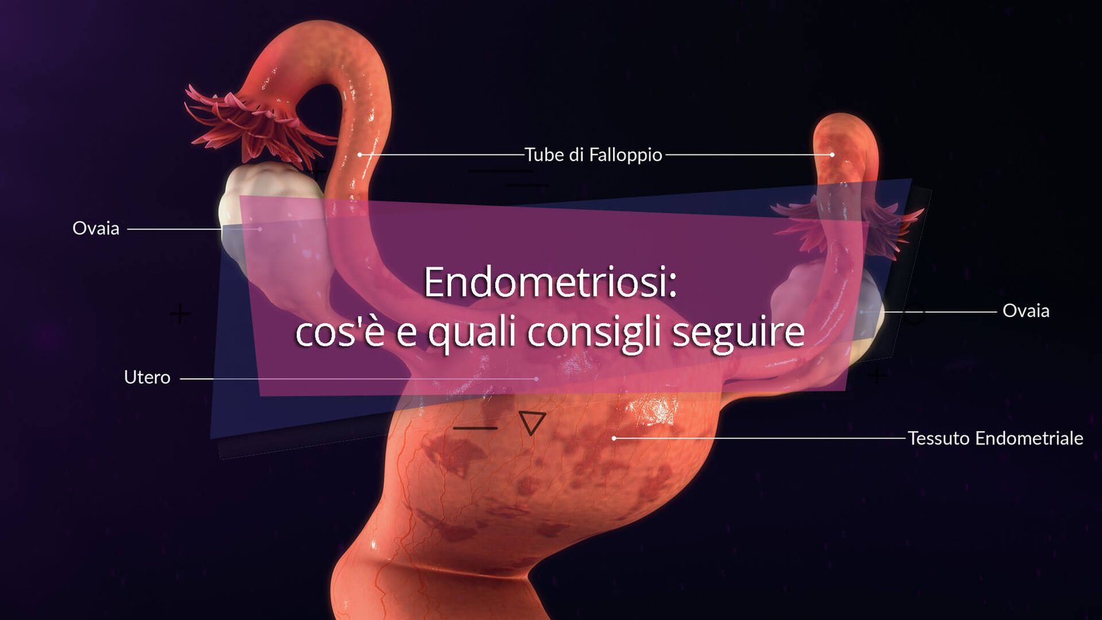 Endometriosi: dolore, fertilità e qualità della vita
