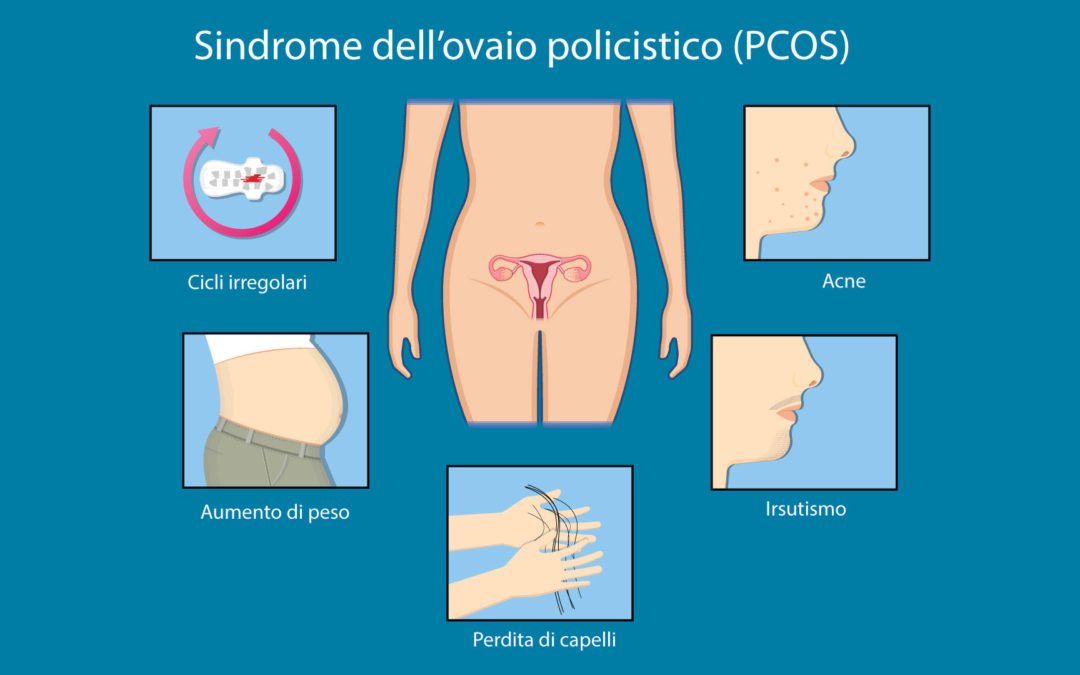 PCOS: gestire sintomi e salute nel tempo