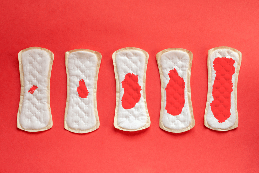 Perdite di sangue in gravidanza: cosa fare