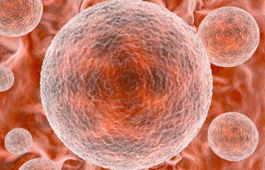 Clamidia: Sintomi, Diagnosi e Cura dell'Infezione Sessualmente Trasmissibile