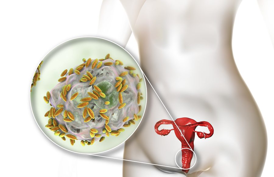 immagine vaginosi batterica trattamenti diagnosi