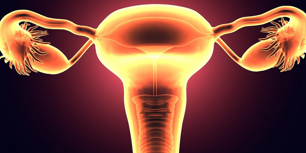 sindrome di rokitansky