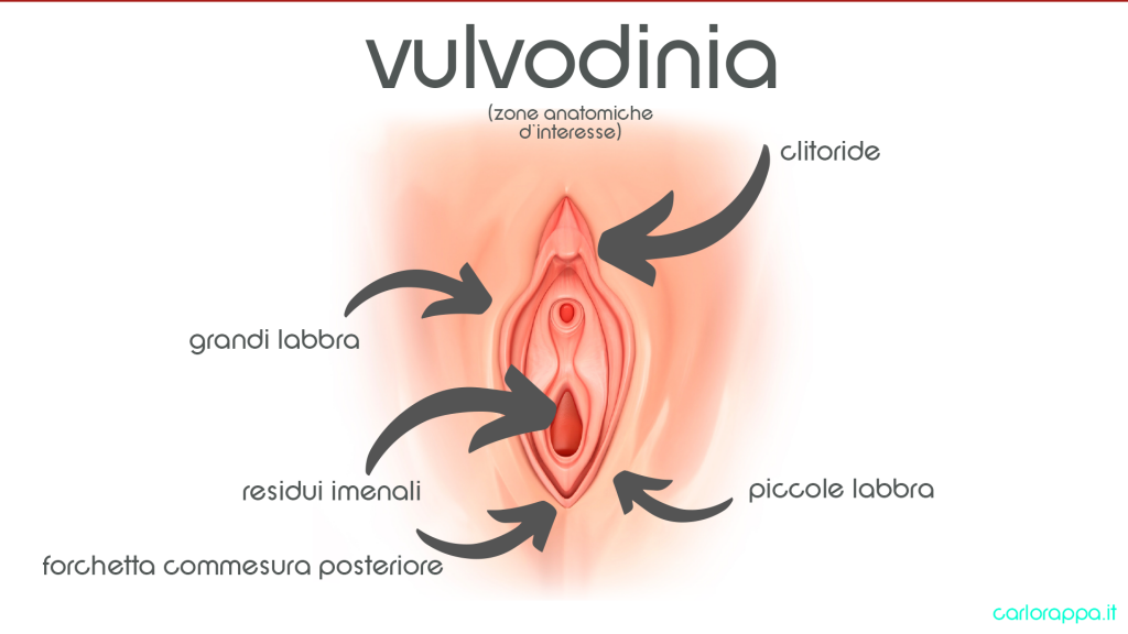 vulvodinia sintomi diagnosi trattamenti