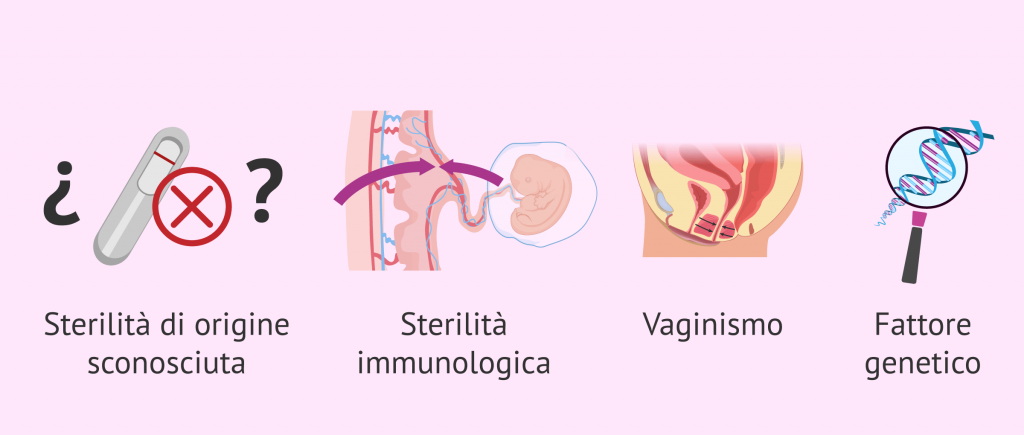IBS fertilità donna ginecologia