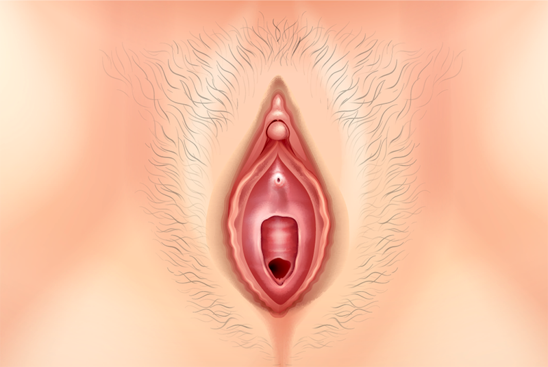 lichen sclerosus skin condition genital