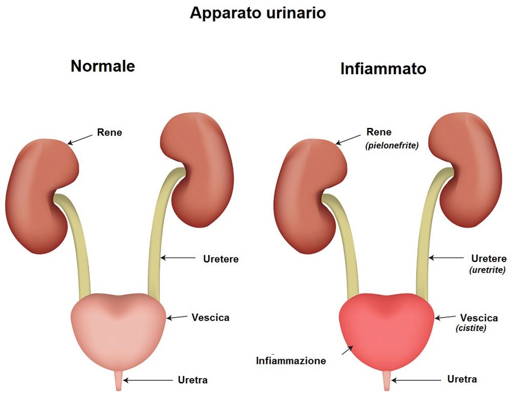 uretocistite sintomi e trattamento urinario
